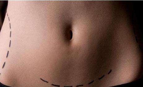 正常陰道分泌物的異常分泌物有哪些類型？