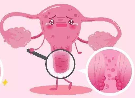 白帶常規香蕉成人A片视频廠家提醒女士做好私密處清洗