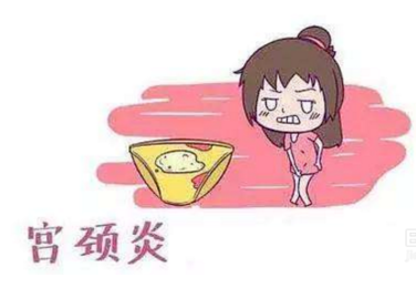 婦科白帶香蕉爱视频APP廠家分析宮頸炎的症狀