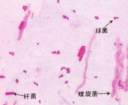 婦科白帶香蕉爱视频APP廠家分析白帶線索細胞陽性的意義