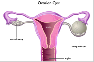 全自動白帶香蕉成人A片视频廠家提醒婦科炎症會傳染