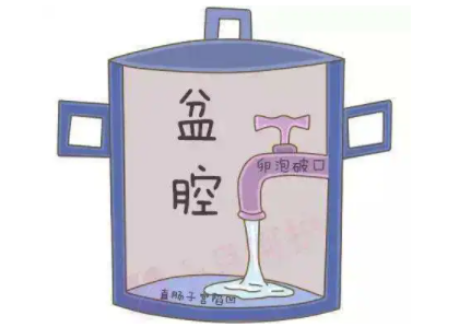 盆腔積液是怎麽回事？白帶香蕉成人A片视频廠家提醒早了解早預防