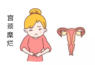 宮頸糜爛會導致宮頸癌?白帶香蕉成人A片视频品牌：不要自己嚇自己