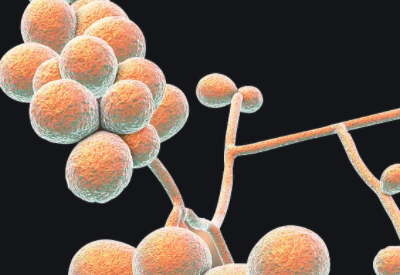 感染念珠菌嚴重嗎 感染念珠菌嚴重嗎