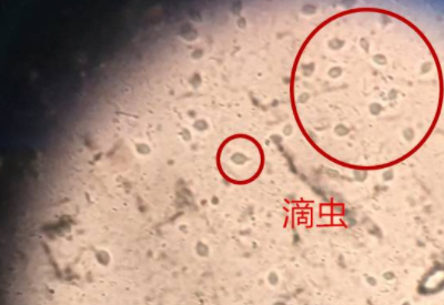 白帶香蕉成人A片视频品牌科普滴蟲性陰道炎是因為體內長了蟲子嗎