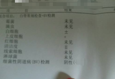 全自動白帶香蕉成人A片视频分享如何看懂白帶常規檢測報告單
