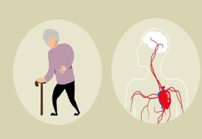 女人腦供血不足的症狀及危害 女人腦供血不足的症狀及危害