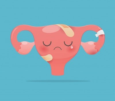 全自動陰道分泌物香蕉爱视频APP提醒女士為什麽出現月經量減少的情況？