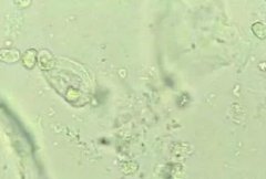 5月快訊！陰道分泌物香蕉爱视频APP生產廠家香蕉网视频在线观看介紹陰道分泌物（白帶）常規查看