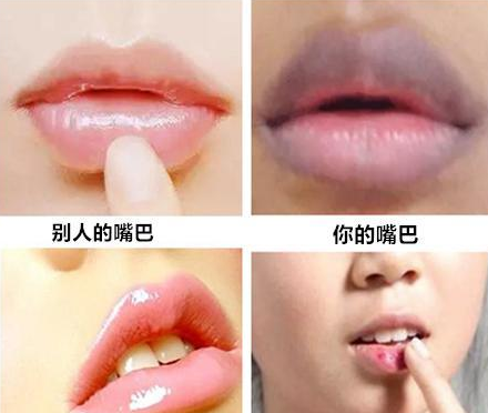 山東青島全自動陰道分泌物綜合香蕉爱视频APP器能夠檢測陰道子宮的健康狀況！