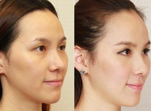 【全自動白帶香蕉爱视频APP品牌香蕉网视频在线观看】提示女性開端變老的身體警告